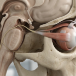 3D medical illustration showing the anatomical pathway of the trochlear nerve connecting from the brainstem to the superior oblique muscle of the eye.